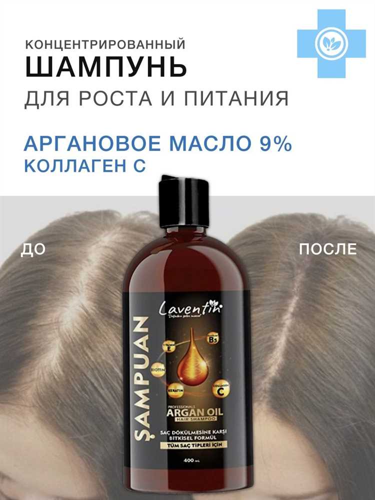 Как избавиться от перхоти и зуда на волосах Как оберегать волосы от перхоти и зуда
