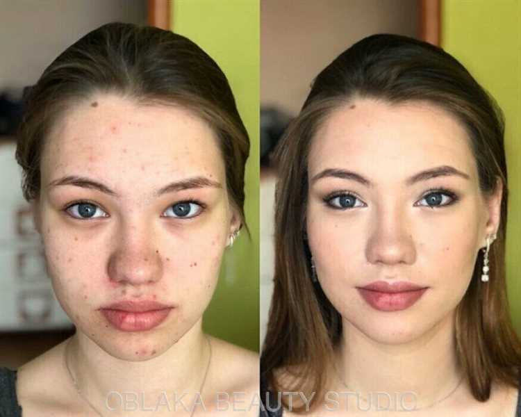 Как уложить волосы для девушек с проблемной кожей