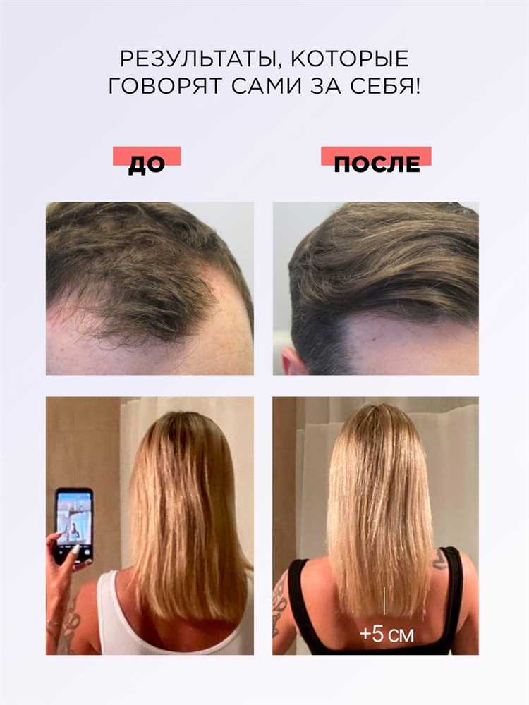 Маски для нормальных волос: красота и здоровье