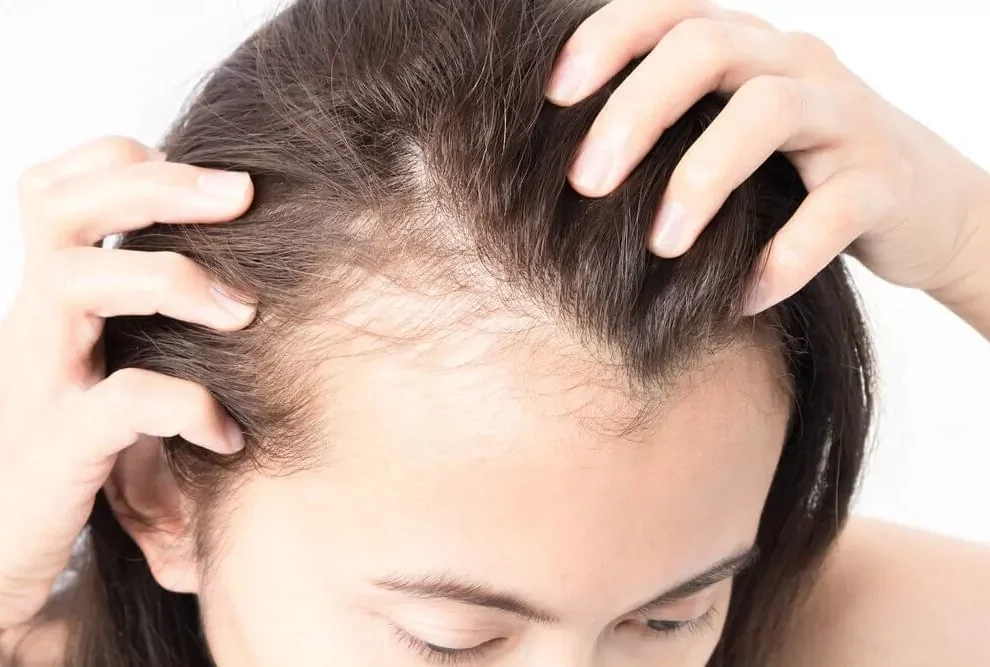 Различные причины выпадения волос и методы борьбы с ними
