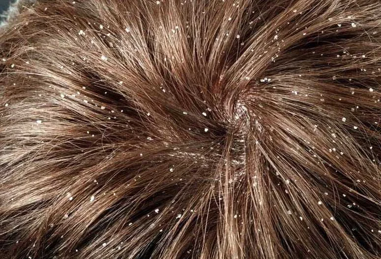 Маски для волос: смягчение последствий стресса и устранение жирности волос 2 Рекомендации по применению масок для волос